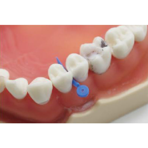 Plastic Wedges with Hole 100 pcs/ pk image 1