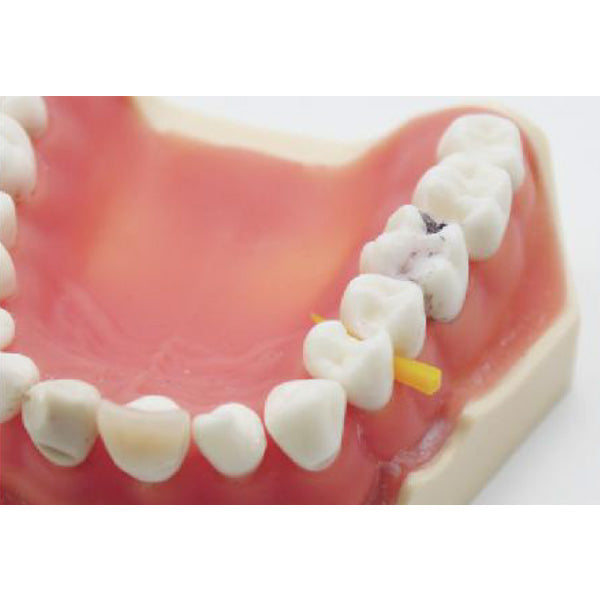 Fixing Plastic Wedges 100 pcs/ pk image 1