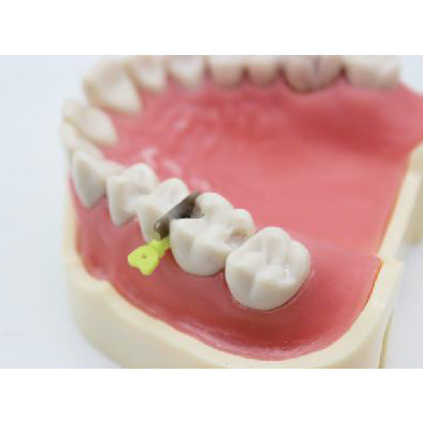 Wedge Guard 24 pcs/ pk image 1